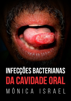 Cover for Infecções Bacterianas da Cavidade Oral