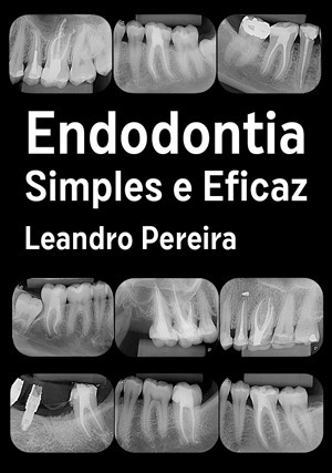 Cover for Endodontia Simples e Eficaz