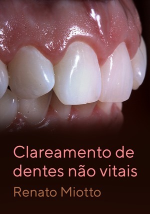 Cover for Clareamento de Dentes não Vitais